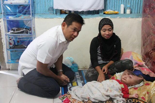 Wujud Kepedulian Kepada Sesama, Kapolda Sulsel Kunjungi Bocah Penderita Hydrocephalus