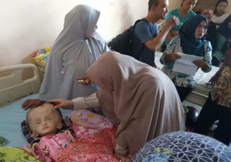 Prihatin, Istri Bupati Wajo, Kunjungi Pasien Hidrosepalus di RSUD Lamaddukelleng